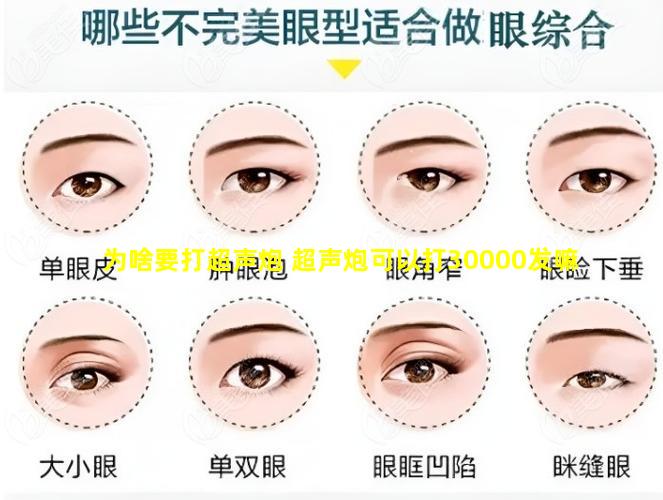 为啥要打超声炮 超声炮可以打30000发嘛